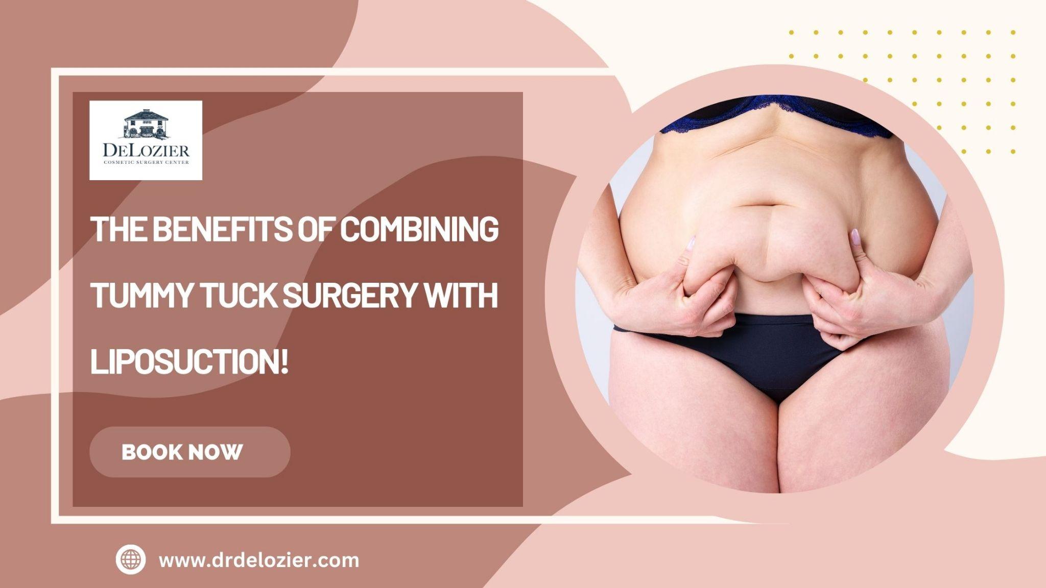 tummy Tuck Surgery