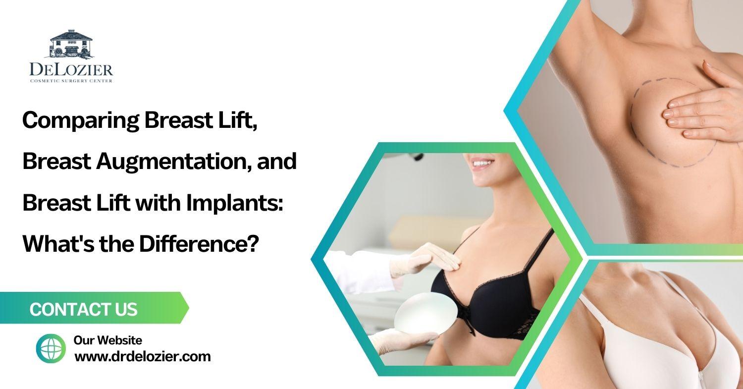 Comparing Breast Lift