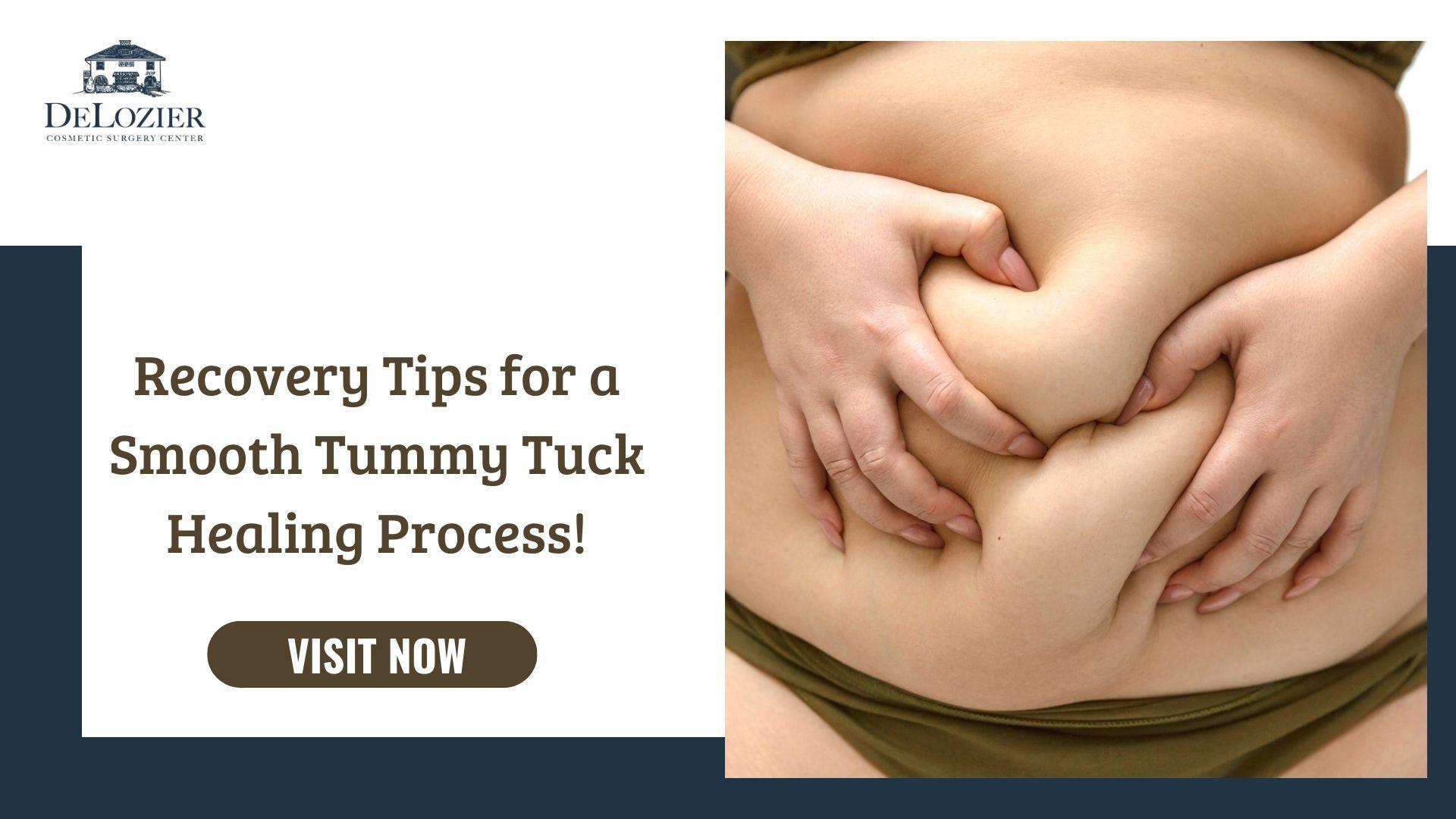 Tummy Tuck