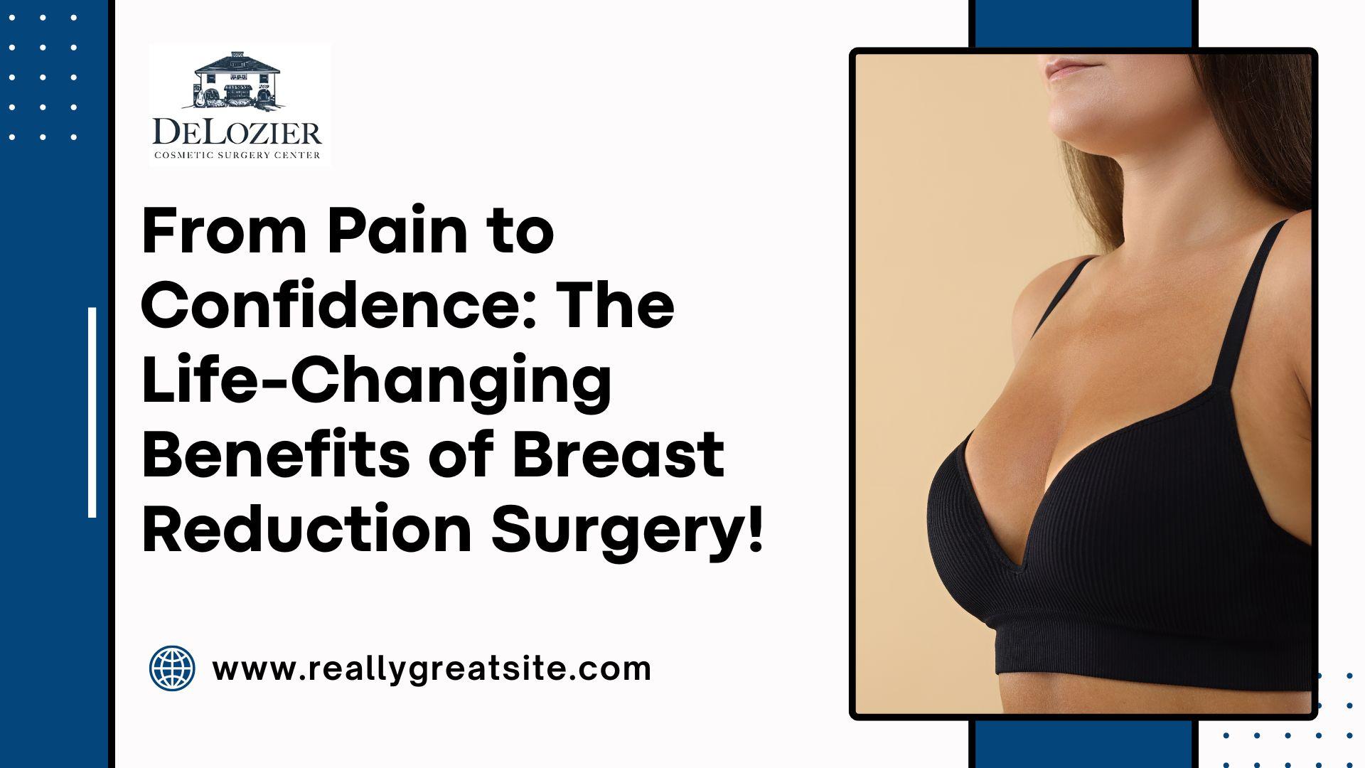 breast reduction surgery