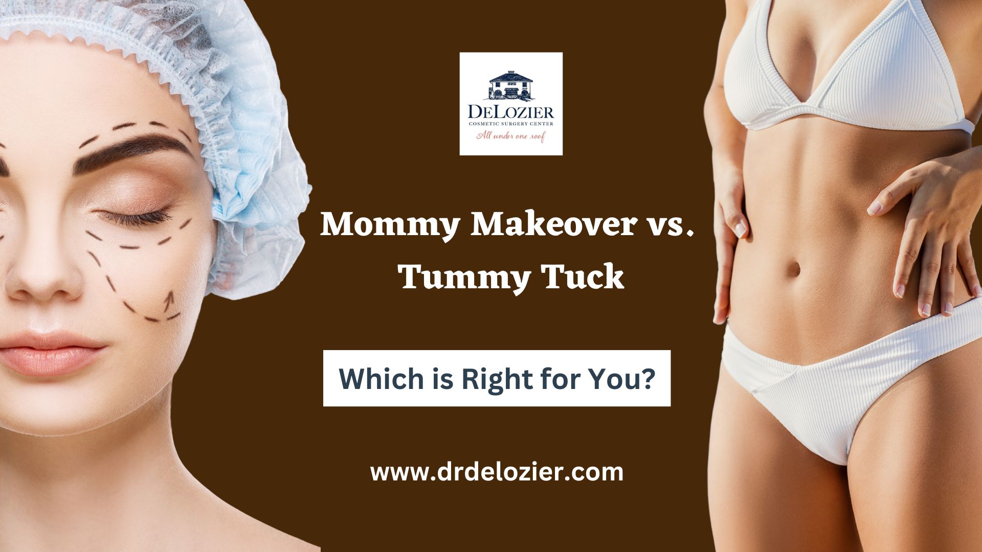 mommy makeover