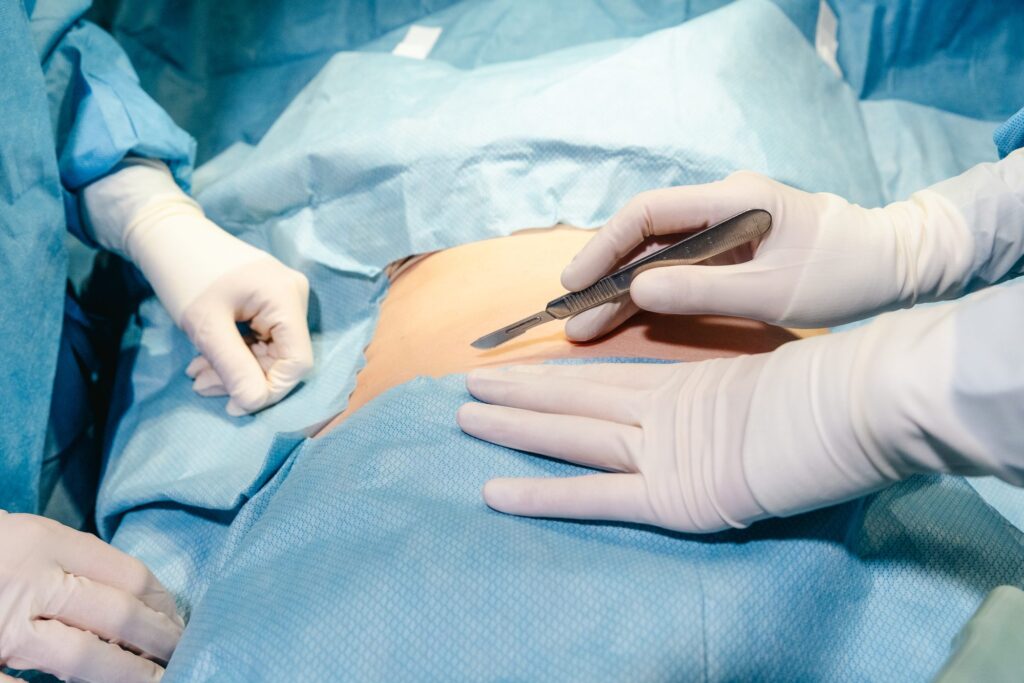 A close-up shot of providers wearing white plastic gloves prepare for an abdominoplasty in Nashville.