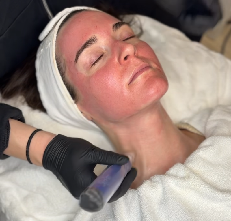 woman receiving a facial in Brentwood, TN at DeLozier Aesthetics